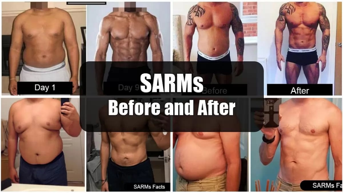 SARMs Before And After Pictures