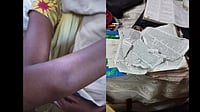 'They Tried To Rip Our Clothes, Tore Bible': Christians Attacked In Delhi During Sunday Prayer Bruises and torn bible