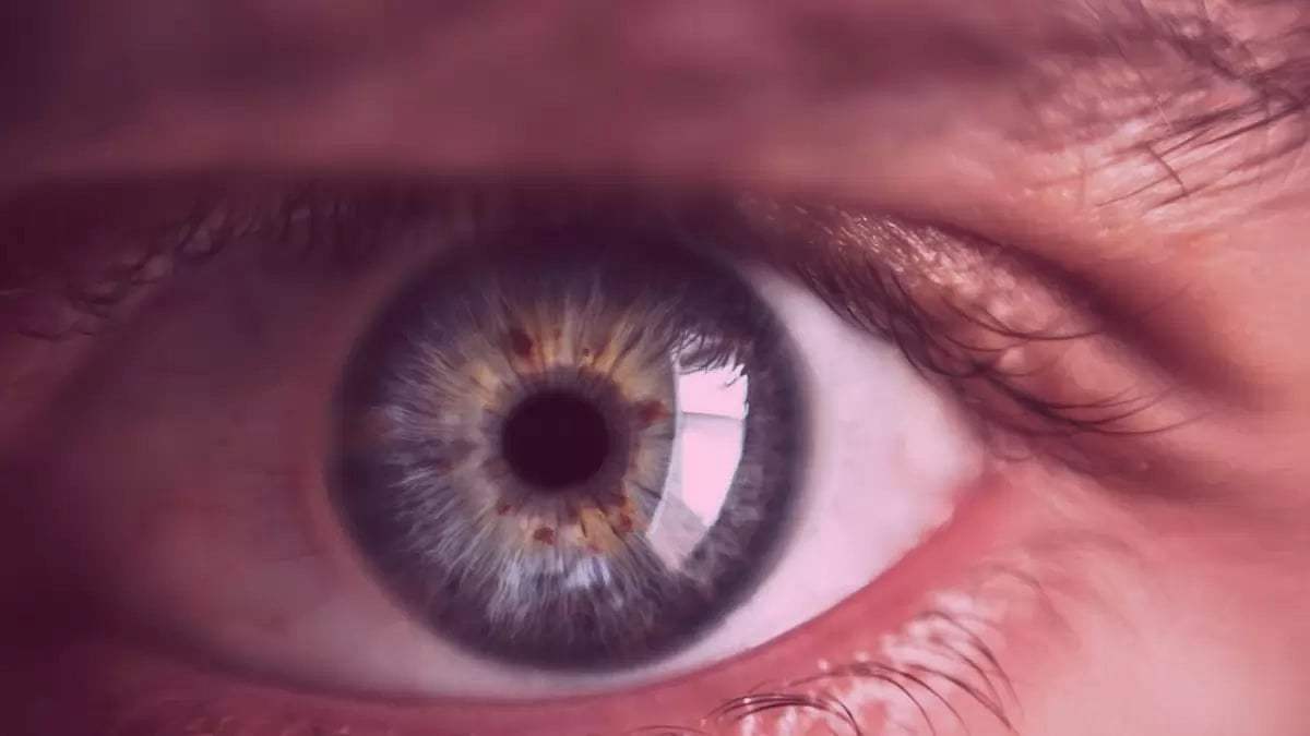 Pink Eye Treatment