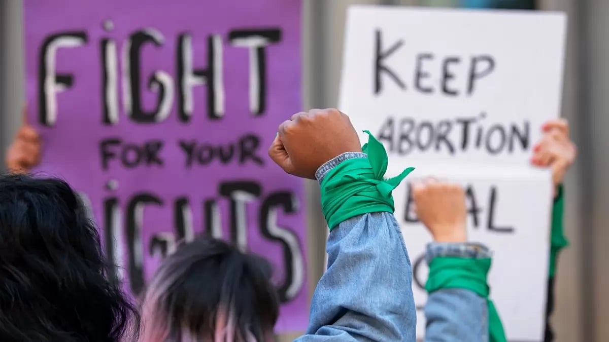 Abortion laws differ in the United States depending upon the state