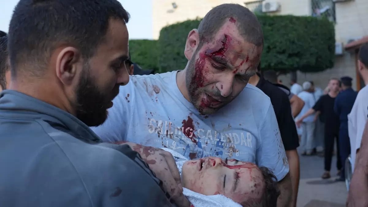 Palestinians wounded in Israeli air strikes on the Gaza Strip at Al-Aqsa Hospital in Deir el-Balah C
