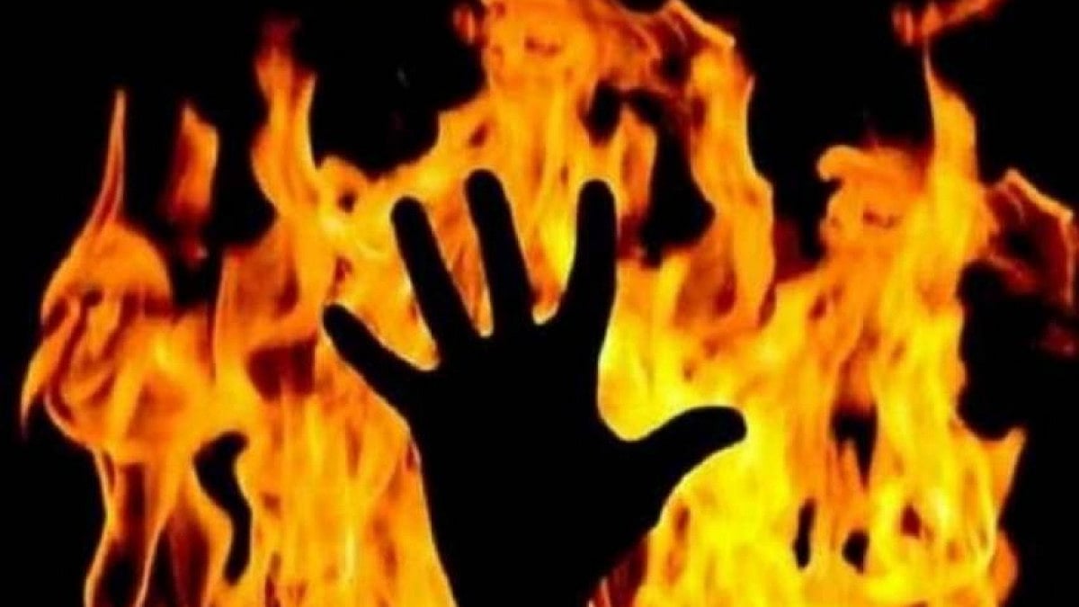 fire (representative image)