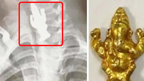 बंगळुरू : चिमुकल्यानं गिळली श्री गणेशाची मूर्ती