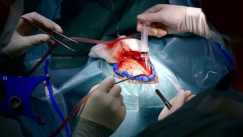 Brain Surgery
