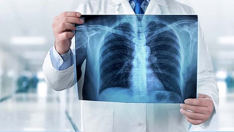 x-ray : आता एक्‍स रेच्‍या माध्‍यमातून होणार कोरोना चाचणी