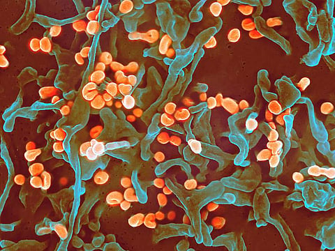कोरोना नंतर आता Lassa Fever चं संकट, तिघांना लागण, एकाचा मृत्यू