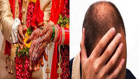 ‘विग’खाली टक्कल लपवणे नवरदेवाला पडले महागात, खावी लागली नवरीची लाथ!