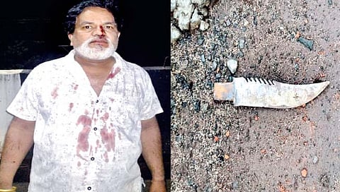 जखमी जगदीश डंबे. सर्‍या छायाचित्रात हल्ल्यात वापरण्यात आलेला सुरा.