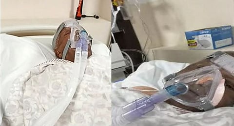लालू प्रसाद यादव यांची प्रकृती गंभीर, आज एअर ॲम्ब्युलन्सनं दिल्‍लीला हलविणार