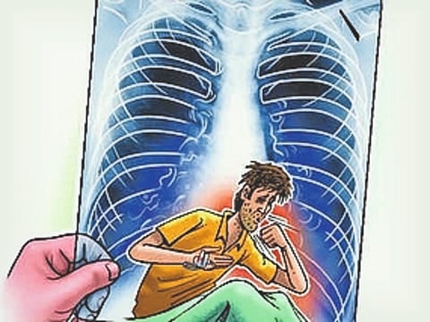 क्षयरोग निर्मूलनासाठी पहिली वॉररूम पुण्यात