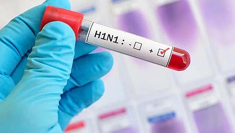 Swine Flu