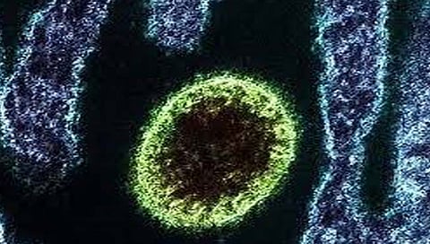 Langya henipavirus