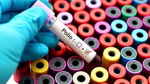 Poliovirus : न्यूयॉर्कला पोलिओ व्हायरसचा वाढता धोका; आणीबाणीची केली घोषणा