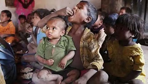 World Hunger Index 2022: नामुष्‍कीचे वास्‍तव..! जागतिक भूक निर्देशांकात भारत पाकिस्‍तान नेपाळच्याही मागे