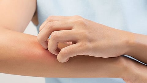बुरशी संसर्गापासून राहा सावध; ‘डब्‍ल्‍यूएचओ’ने जाहीर केली 19 संसर्गांची यादी