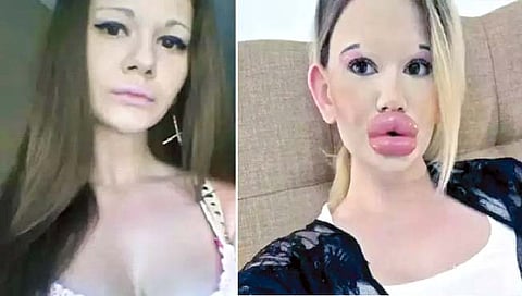 Cosmetic surgery  