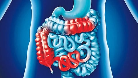 digestion 