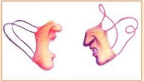 Anger 