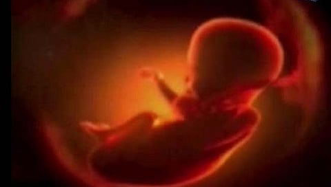 कोल्हापूर : गर्भलिंग निदानप्रकरणी बोगस डॉक्टरलाही अटक; दोघांना पोलिस कोठडी
