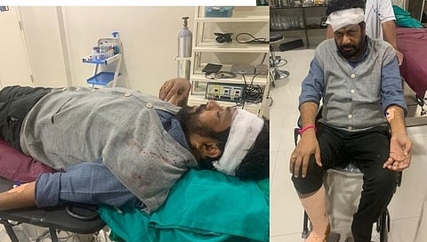 Bacchu Kadu Accident News : आमदार बच्चू कडू यांना भरधाव दुचाकीने उडवले; डोक्याला आणि पायाला गंभीर दुखापत 