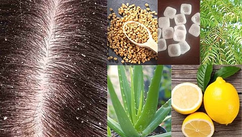 Hair dandruff