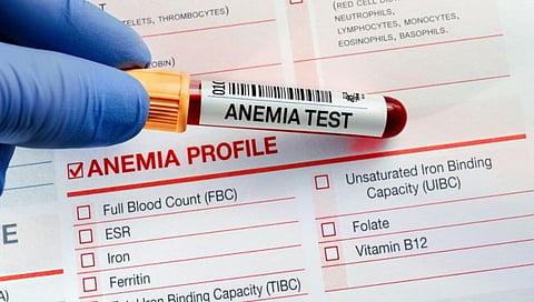 Anemia in children 