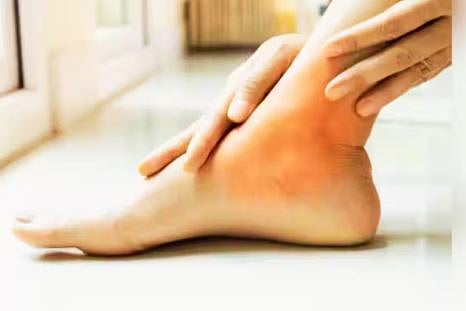 uric acid