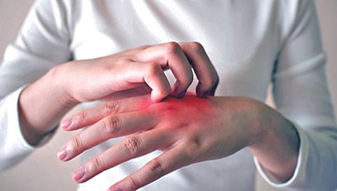 Diabetes and Skin Problems : मधुमेह आणि त्वचेच्या समस्या, जाणून घ्‍या सविस्‍तर