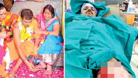 आईसाठी स्वतःच्या कातड्यापासून बनवली चप्पल