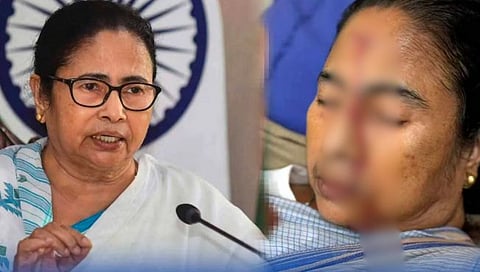 मोठा बातमी! ममता बॅनर्जींच्या डोक्याला गंभीर दुखापत! रक्तस्त्राव होत असल्याचा फोटो व्हायरल