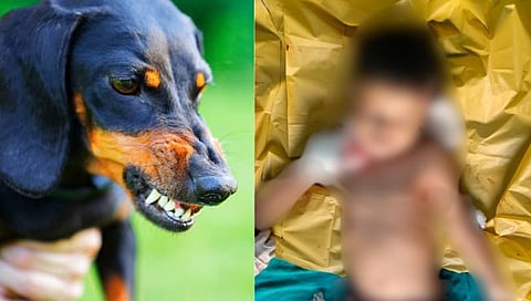 मोकाट कुत्र्यांच्य़ा हल्ल्यात बालकाचा मृत्यू