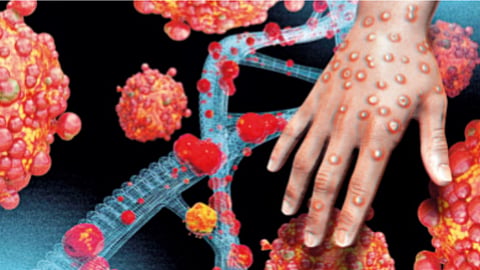 mpox, mpox advisory