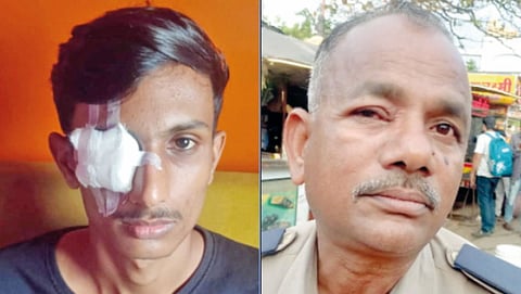 Young man's eye seriously injured by laser