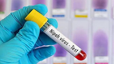 Nipah virus
