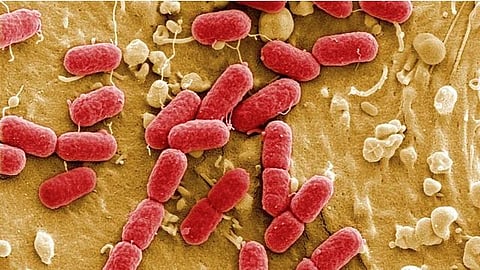 Antimicrobial Resistance (AMR) 