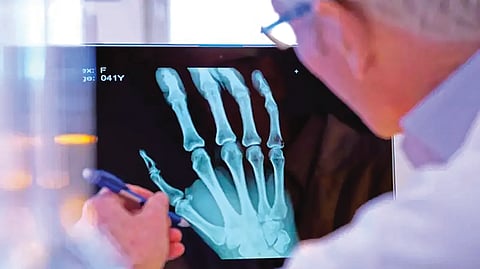 MRI, X-ray, Sonography, CT Scan