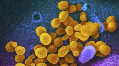 HMPV, Human Metapneumovirus 