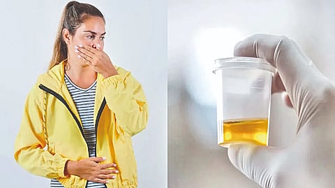 Foul smelling urine