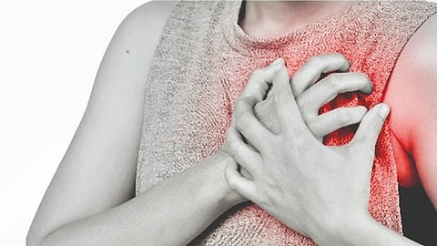 Heart attack