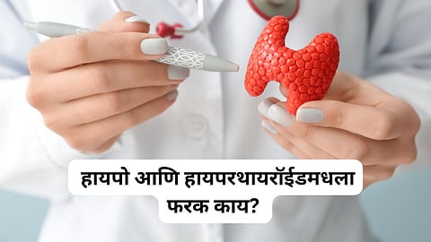 Thyroid Causes 