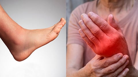 Chronic inflammation 