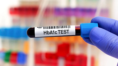 Health Checkup