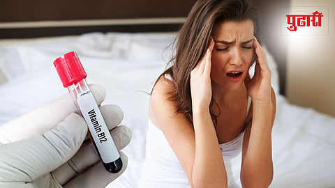 Vitamin B12 Deficiency 