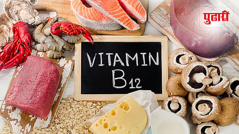 Vitamin B12 Deficiency 