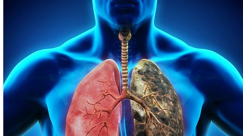 Environmental Health