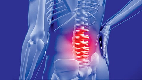 risk of ankylosing spondylitis