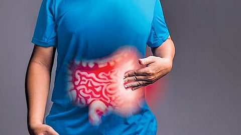 GERD problem