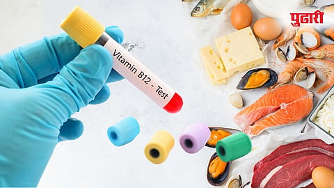 Vitamin B12 Deficiency Symptoms