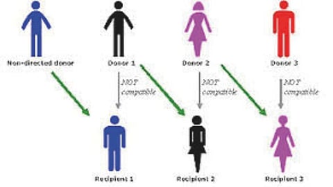 Organ Swap Transplant India 
