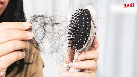 Hair Fall Reasons